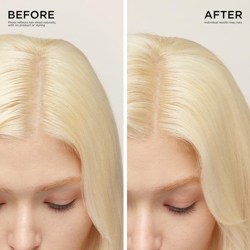 Hair & Scalp Dynamic Duo Set