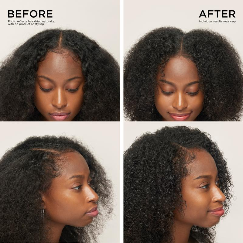 Hair & Scalp Dynamic Duo Set
