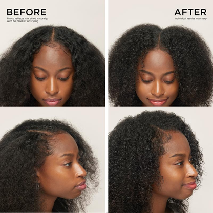 Hair & Scalp Dynamic Duo Set
